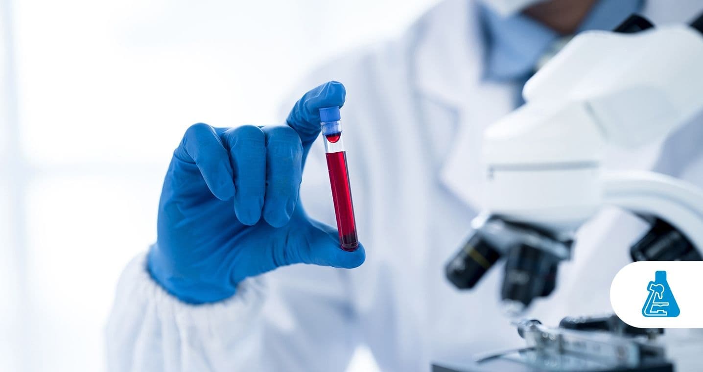 Hemograma_ o que é, preparação do exame e mais! - 1436x760-compressed.jpg